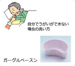 自分でうがいができない場合の洗い方